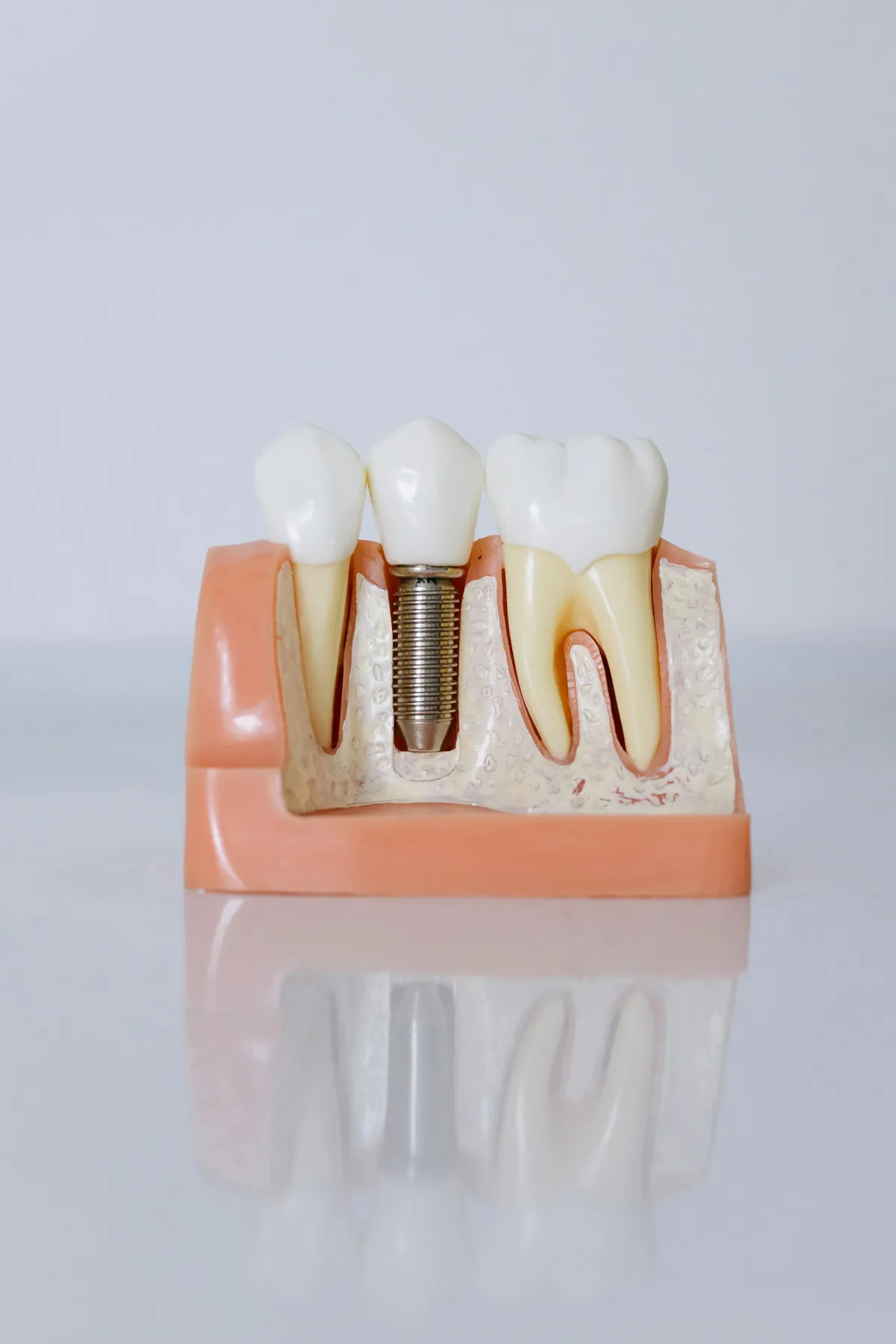 Lady who got her teeth cleaned