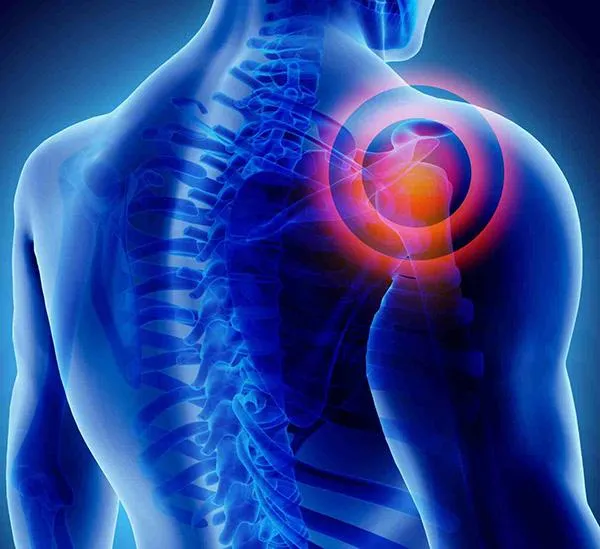 shoulder pain blue diagram