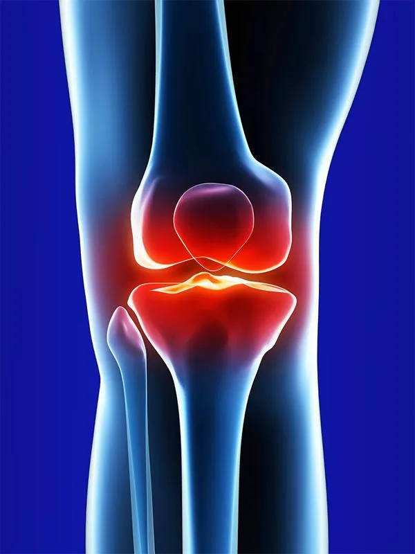 knee pain blue diagram