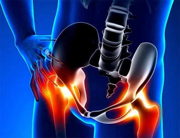 sciatica pain blue graphic