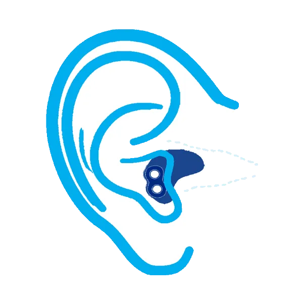 Modern hearing aids