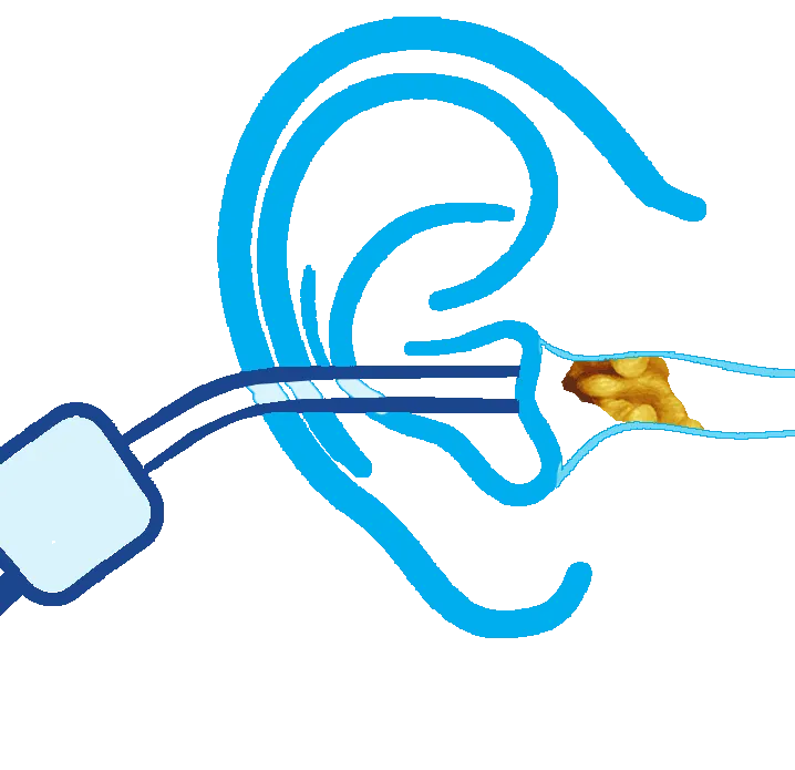 Hearing Tests and Hearing Assessments