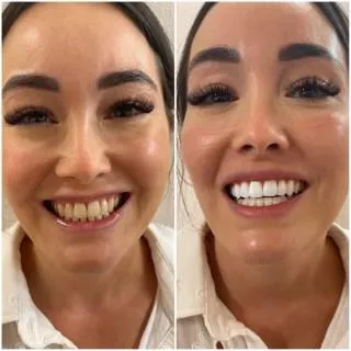 Dentitox Pro example