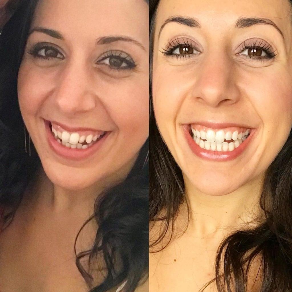 Dentitox Pro About