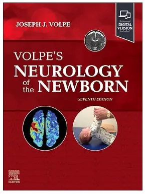 Volpe's 7th edition