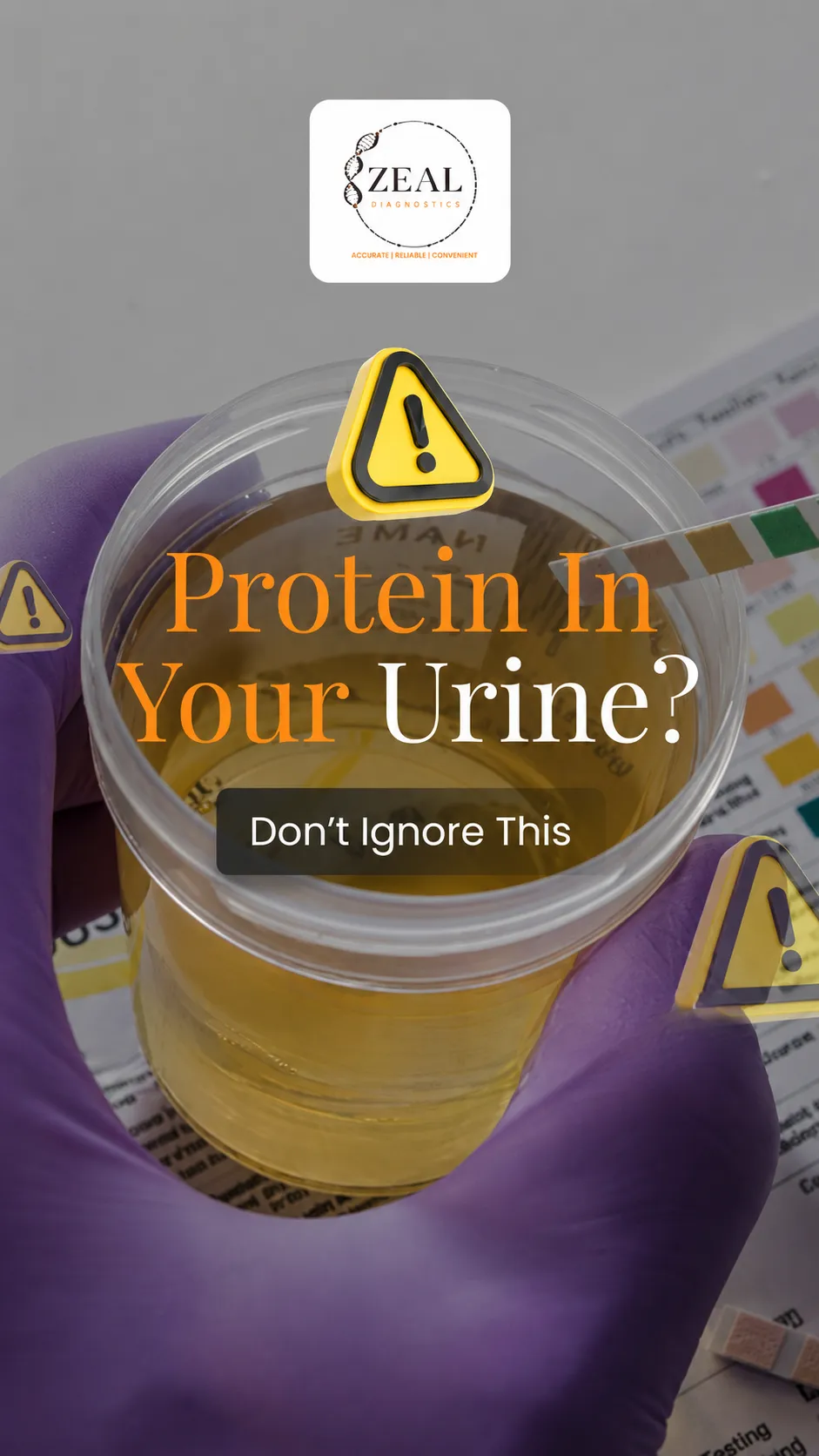 Kidney illustration showing protein leakage in urine indicating early kidney stress and filtration issues