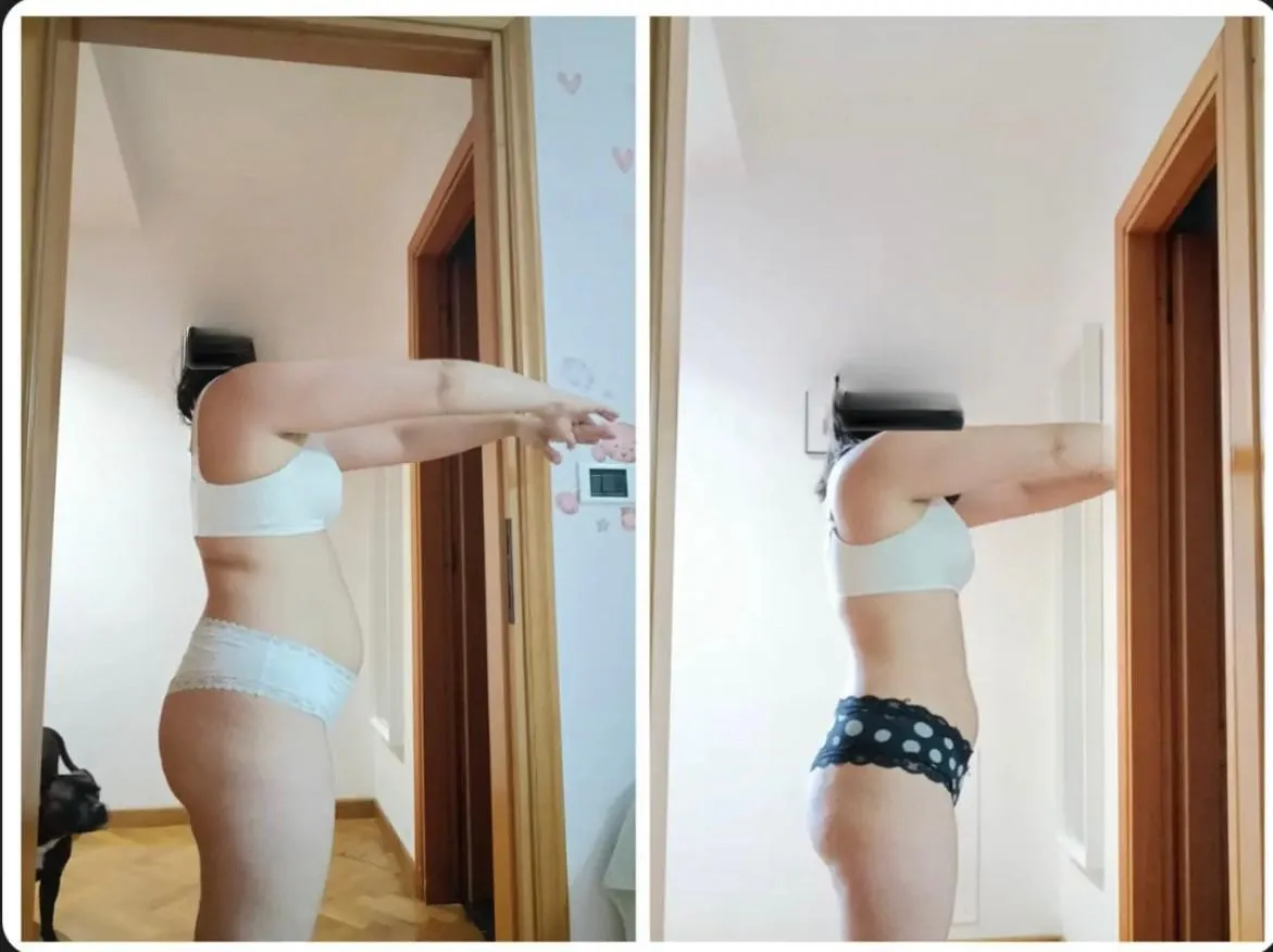 Antes e Depois Vanessa