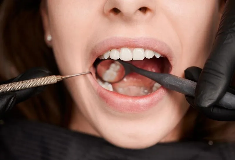 Same Day Emergency Dentist Sacramento – Walk-In Appointments Available