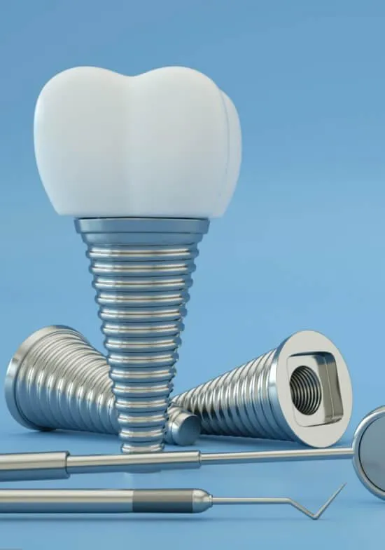 Are dental implants right for me?