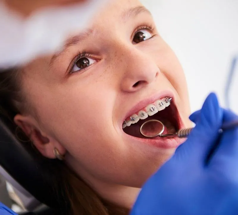 Braces