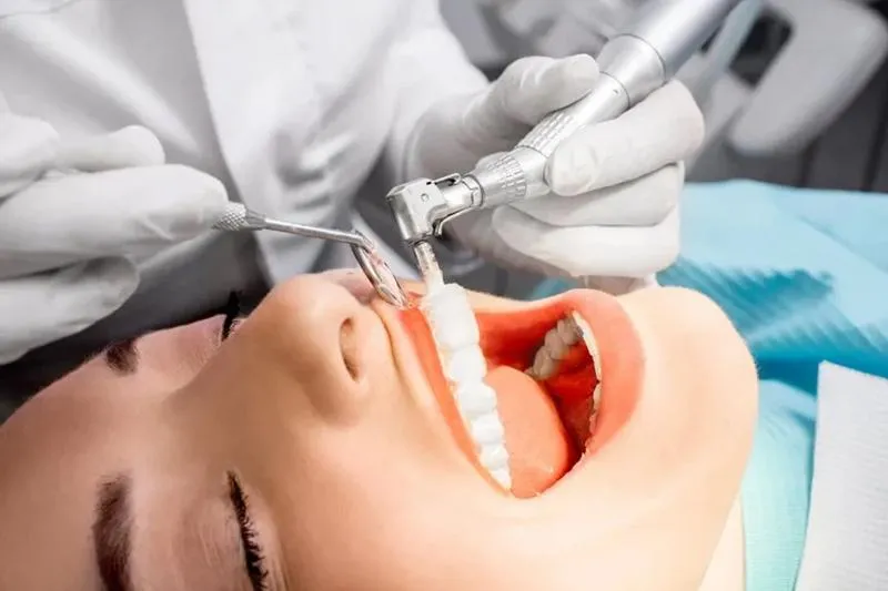 What is Fluoride Treatment?