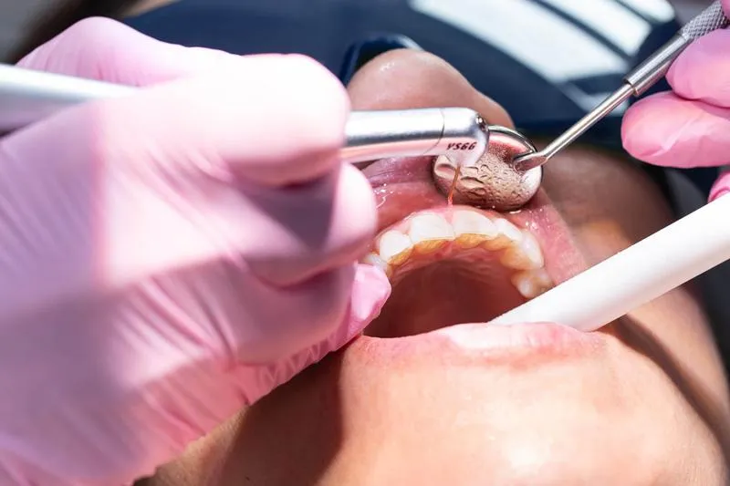 Same Day Emergency Dentist Sacramento – Walk-In Appointments Available