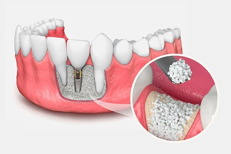 Emergency Dentist Sacramento CA – Fast, Reliable Urgent Dental Care
