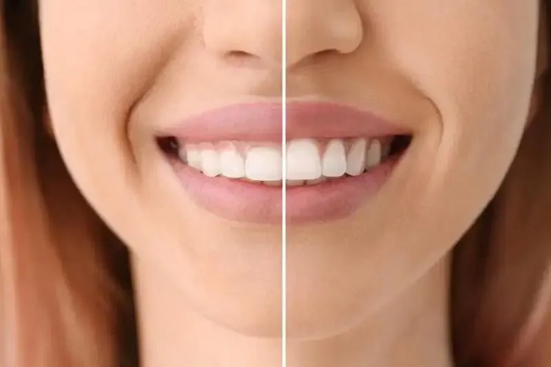 Emergency Dentist Sacramento CA – Fast, Reliable Urgent Dental Care