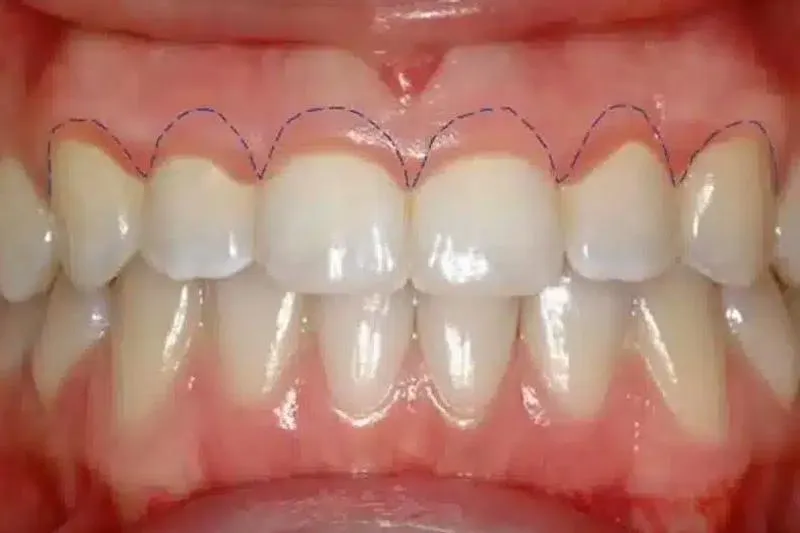 Emergency Dentist Sacramento CA – Fast, Reliable Urgent Dental Care