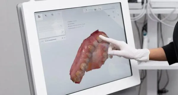 Intraoral Cameras & 3D Scanning