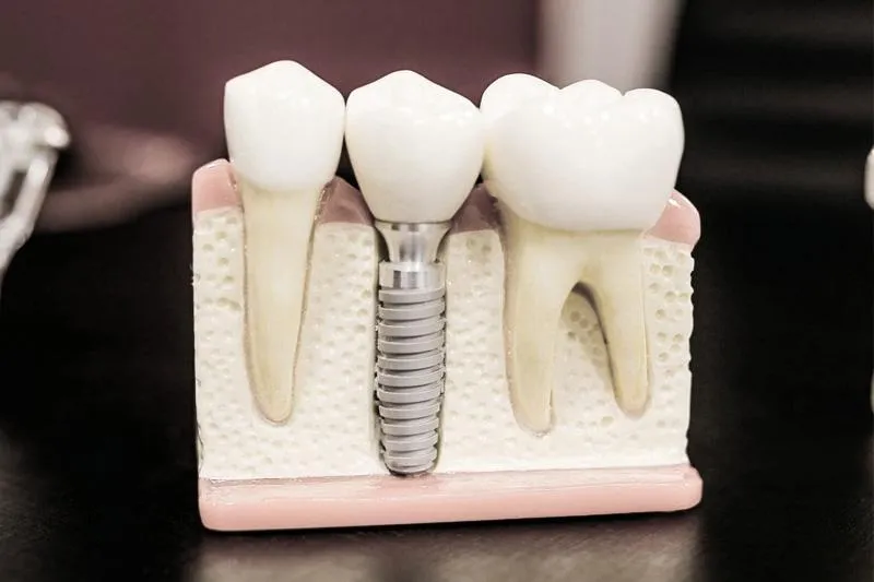 Trusted Restorative Dental Care near Sacramento