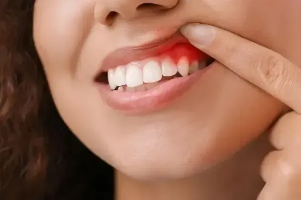 Gum Care