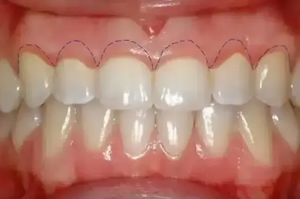 Emergency Dentist Sacramento CA – Fast, Reliable Urgent Dental Care