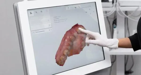 Intraoral Cameras & 3D Scanning