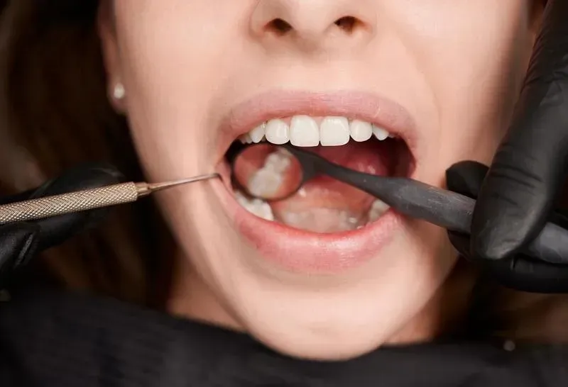 Same Day Emergency Dentist Sacramento – Walk-In Appointments Available