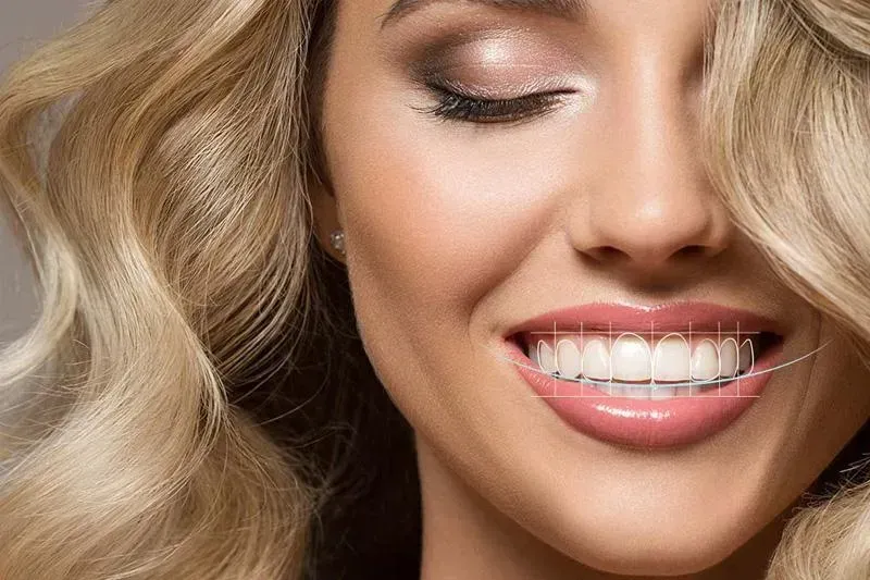 Why Choose Porcelain Veneers?