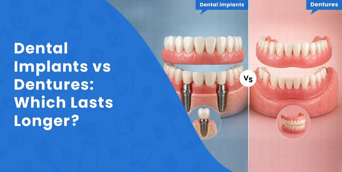 Tooth Replacement Options in Sacramento CA | Dental Implants, Dentures & More