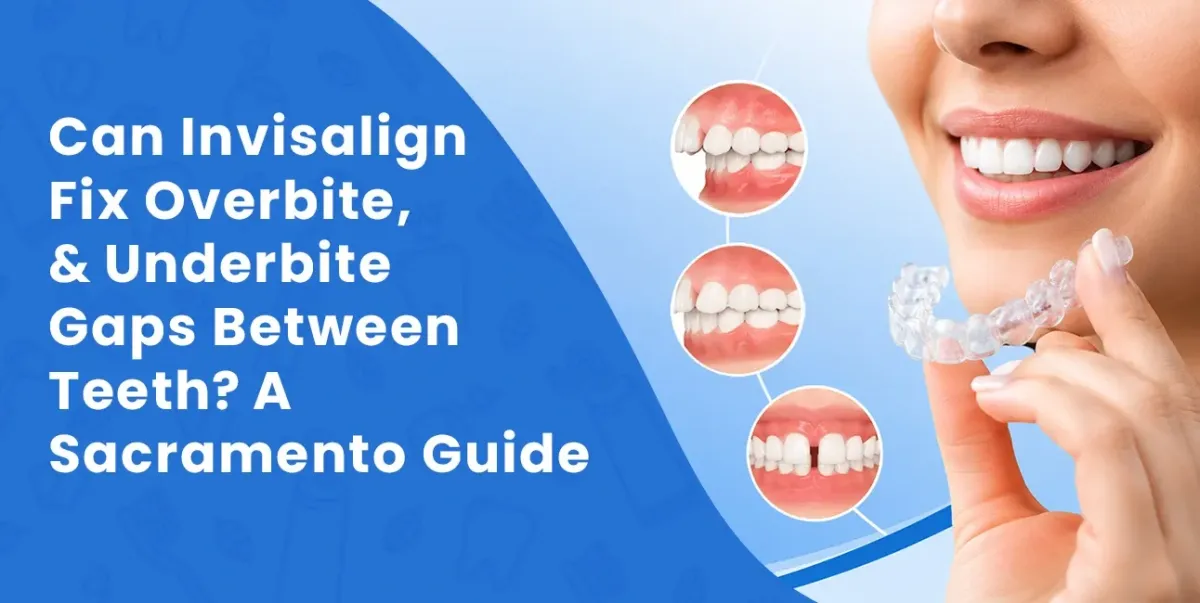 Can Invisalign Fix Overbites, Underbites & Gaps? | Sacramento