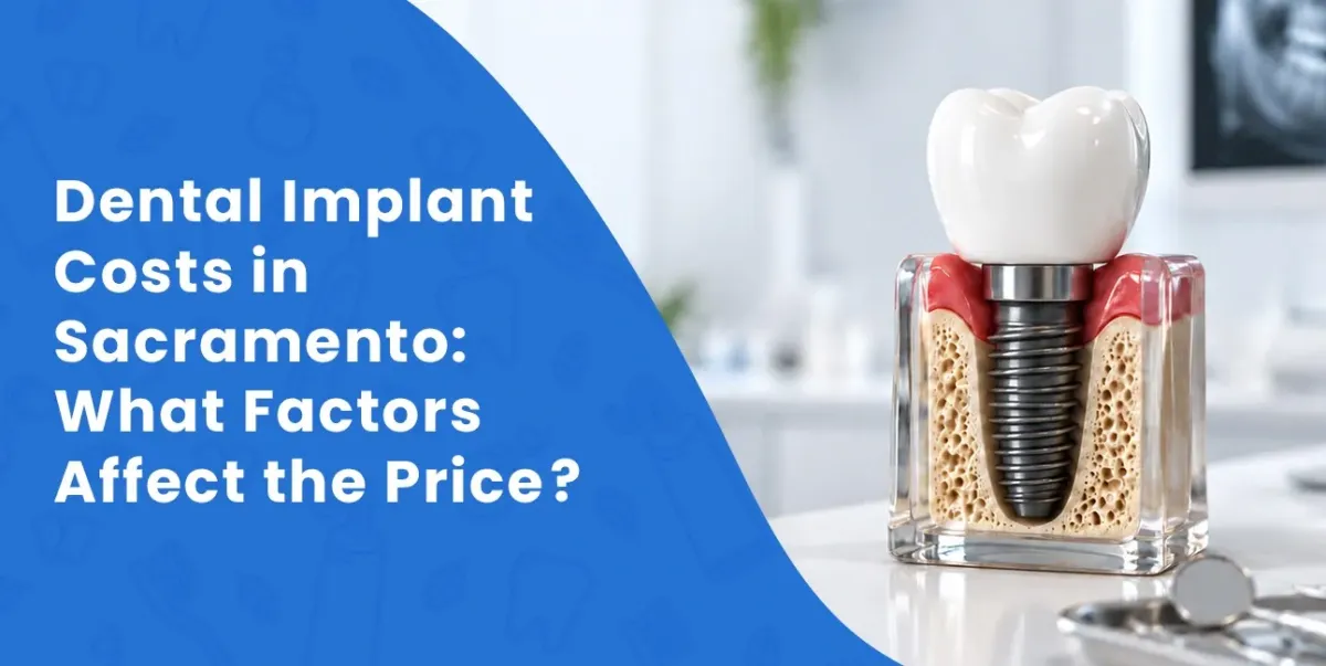 Dental Implant Costs in Sacramento: What Factors Affect the Price?