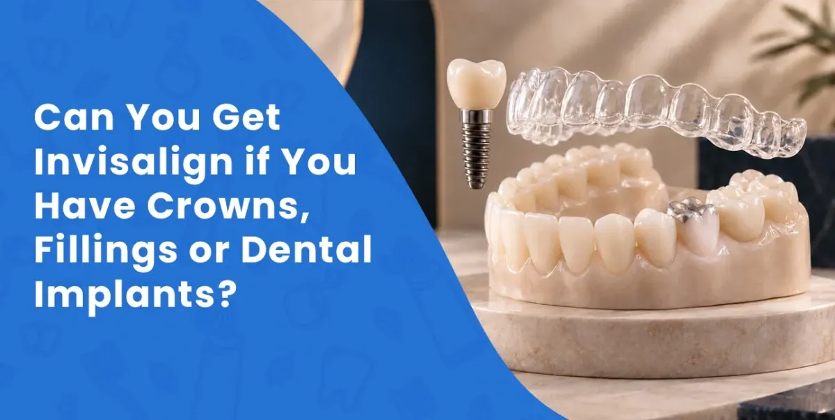 Invisalign With Crowns, Fillings or Implants? | Stonebrook