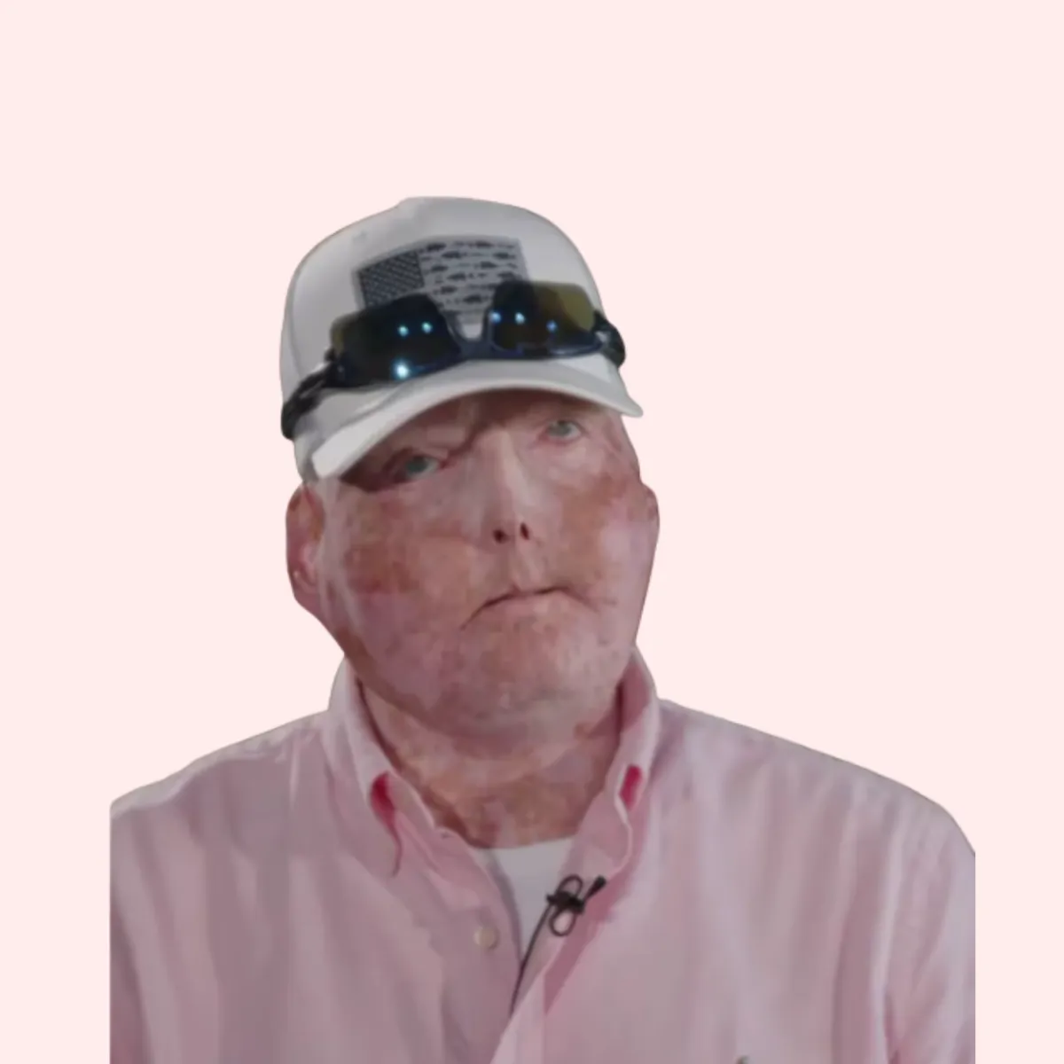 Christian memoir author Pat Hardison, Mississippi firefighter and burn survivor