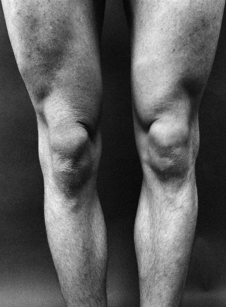 Clinical assessment of foot and ankle alignment