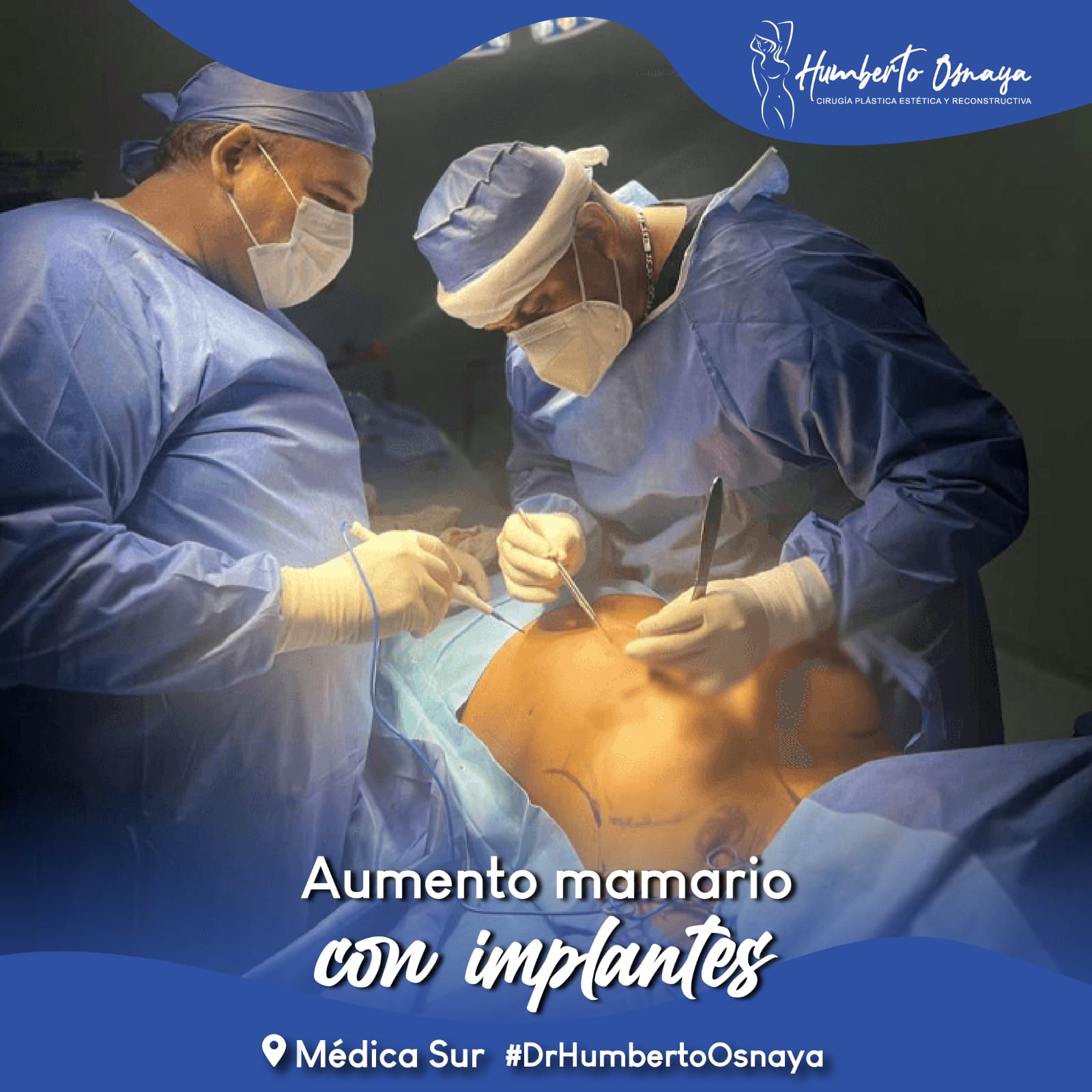 Consulta médica de valoración para ginecomastia