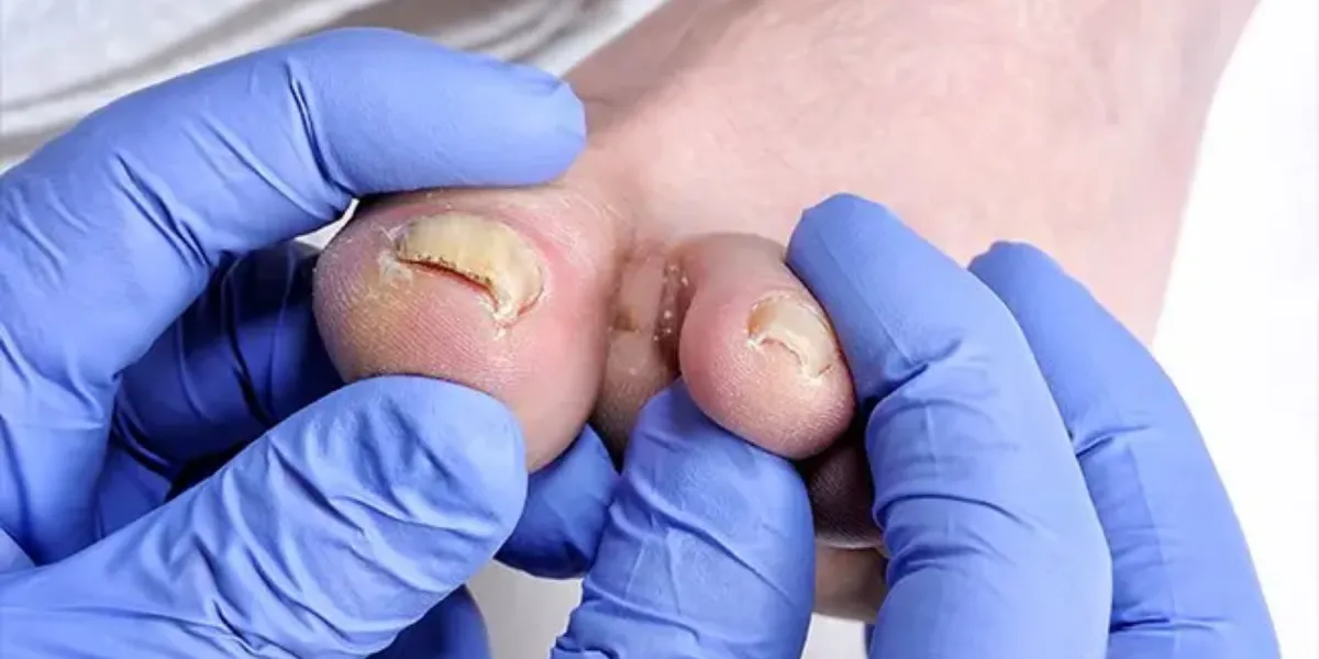 Routine Podiatry