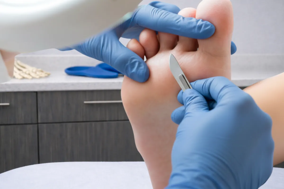 Treatment Options
