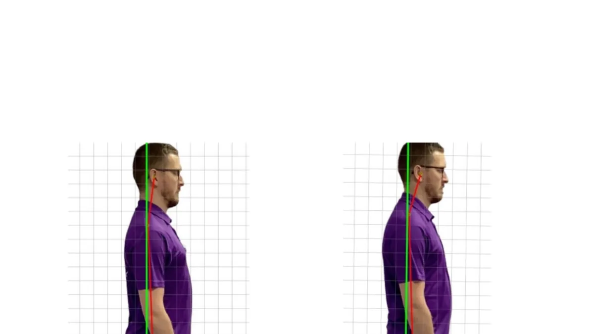 Matt Posture picture 