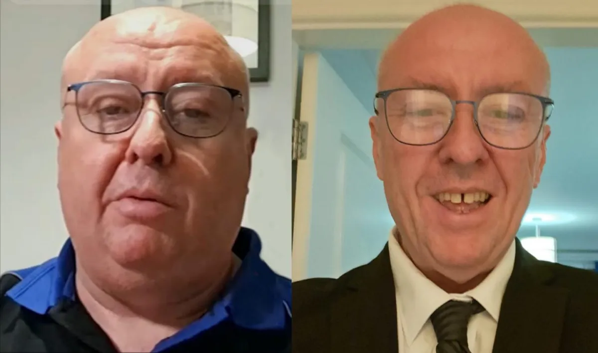 2 black and gray dumbbells on green grass