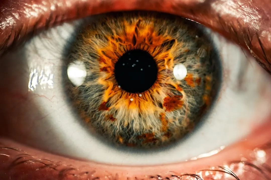 ojo 