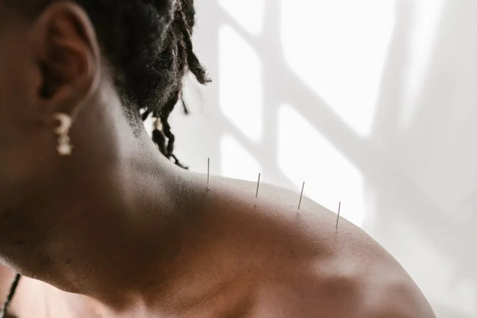 Acupuncture Near Cornerstone Calgary: What to Expect Before You Book