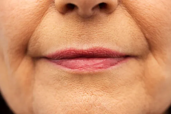 What's Behind Thinning Lips After 50 (and How to Fix It) ⭐