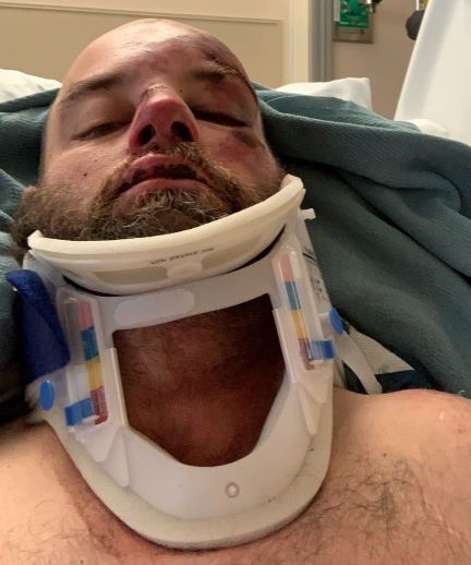 Matt Maycumber recovering in the hospital after a motorcycle wreck — cervical collar, eyes closed, healing in progress