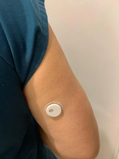Continuous glucose monitoring (CGM) device used for metabolic optimization and longevity at Age-X Clinics