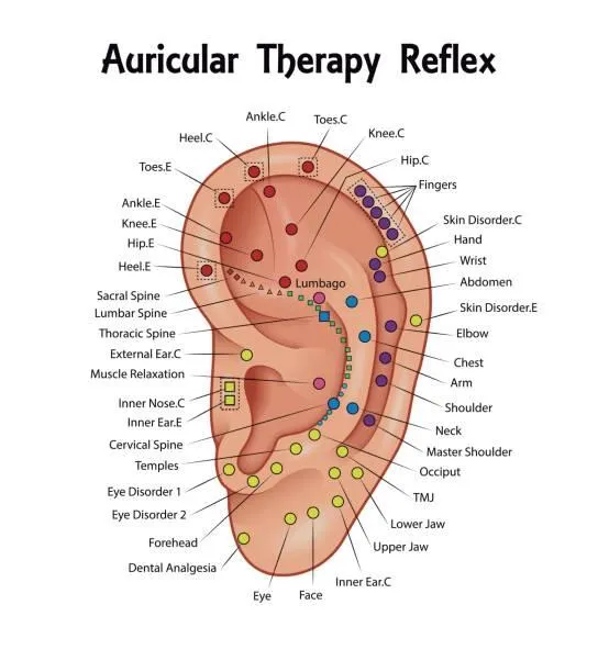 Auricular Acupuncture Image