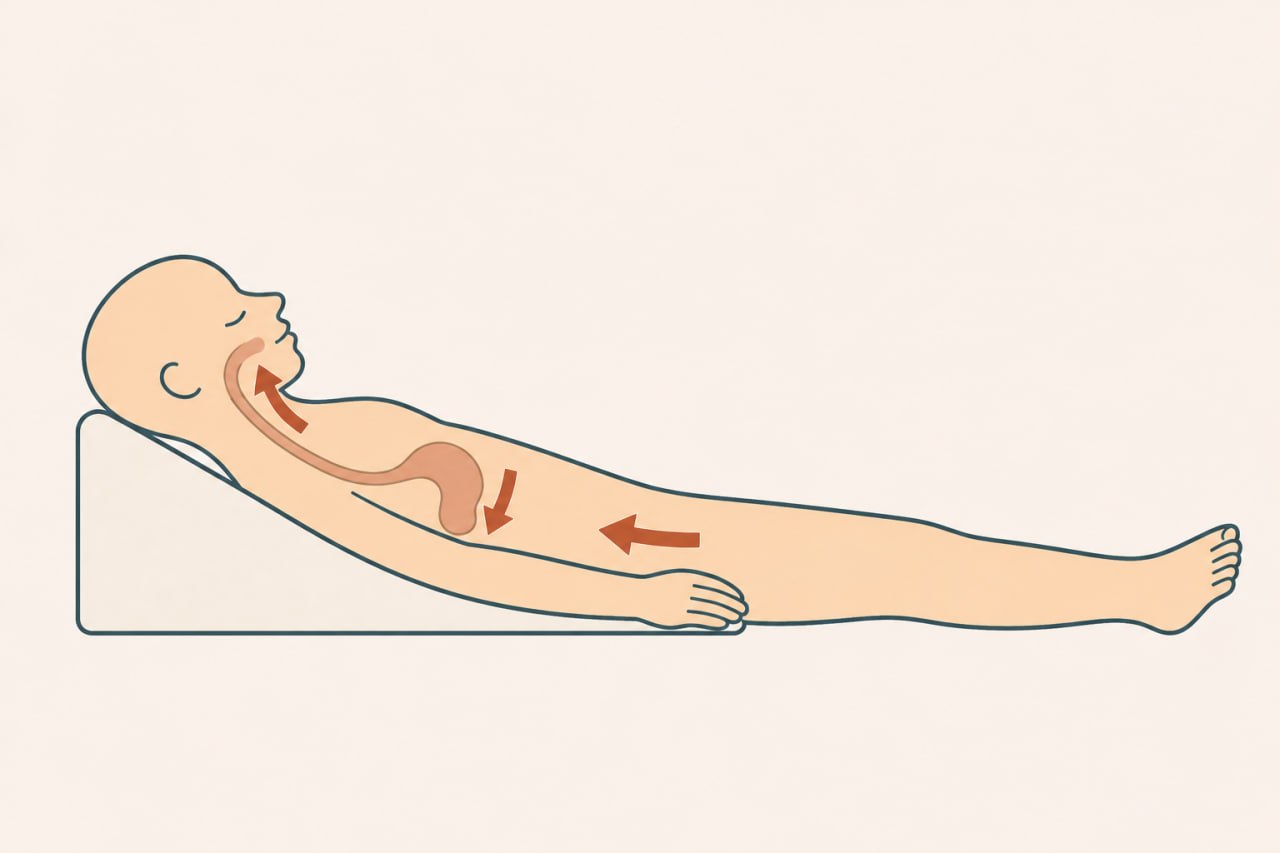 Medical illustration showing a human figure on a wedge pillow with a bent waist