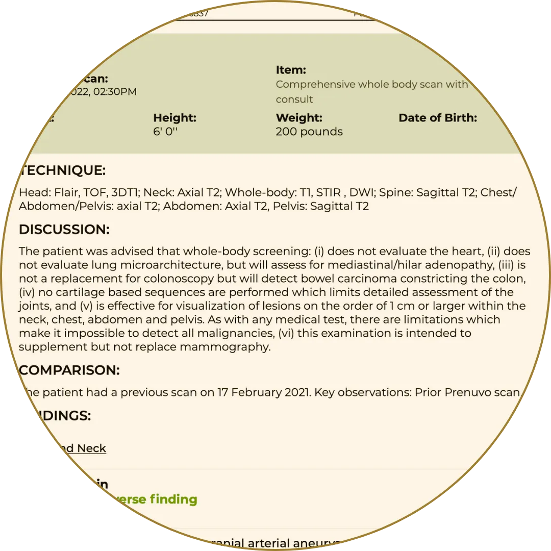 MRI scan report detailing full-body imaging methods, limitations, and diagnostic value for lesions and internal assessment.