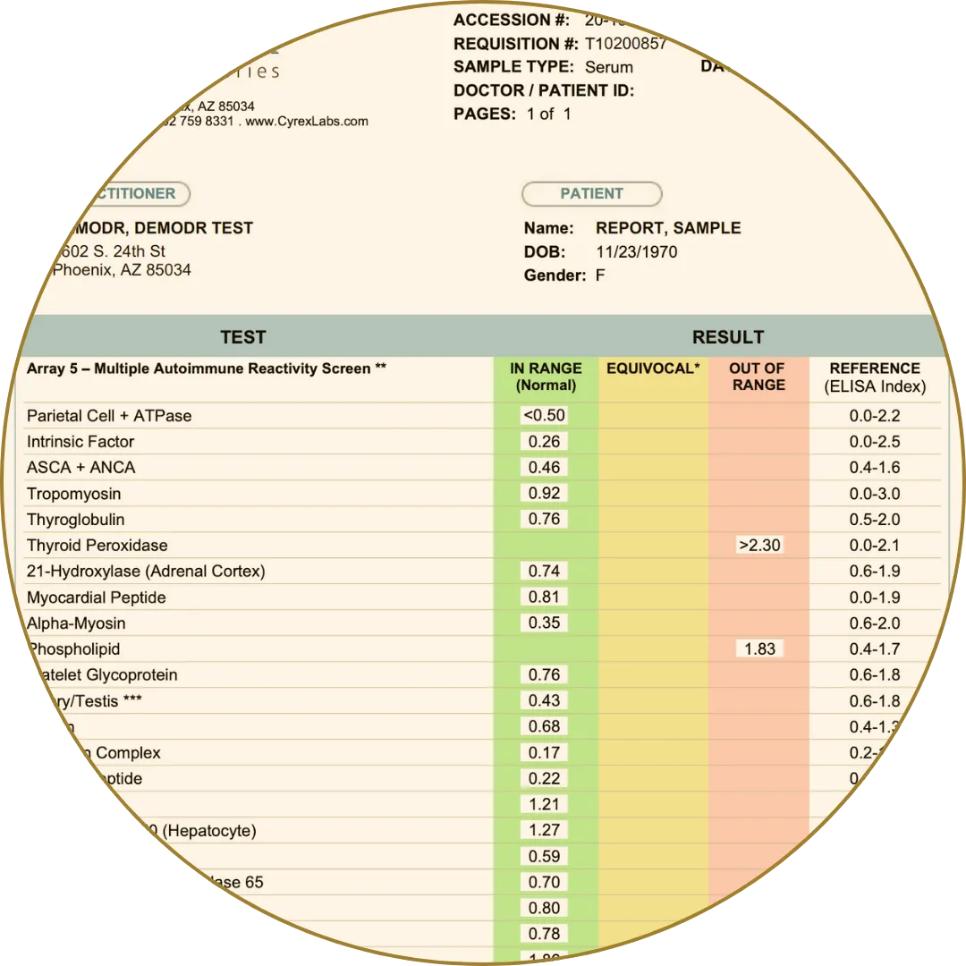 Autoimmune reactivity screen with test results for multiple markers like thyroid and myocardium.