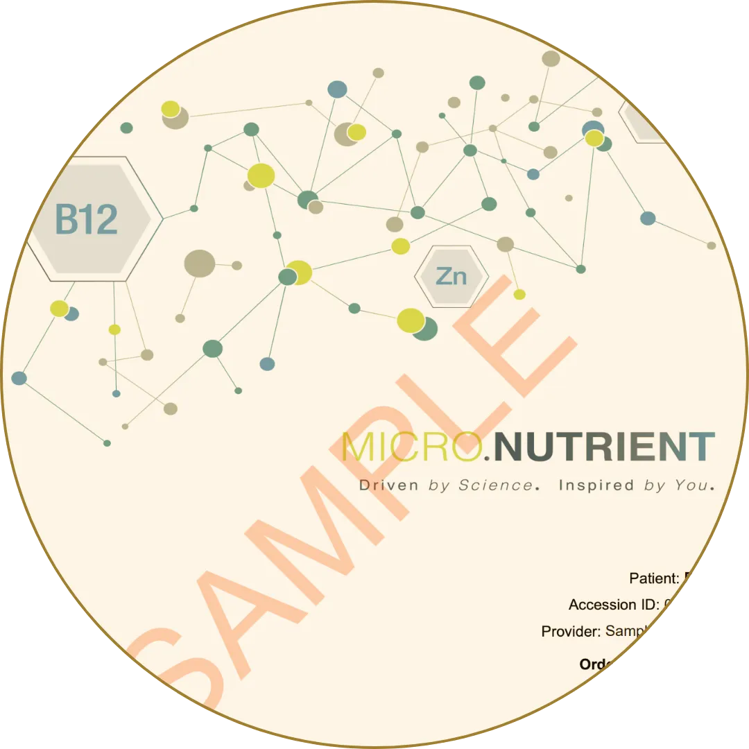 Micronutrient test sample report showing network of elements like B12 and Zinc.