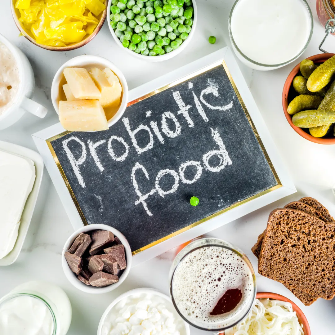 Assorted probiotic foods with a chalkboard sign labeled “Probiotic food” in the center.