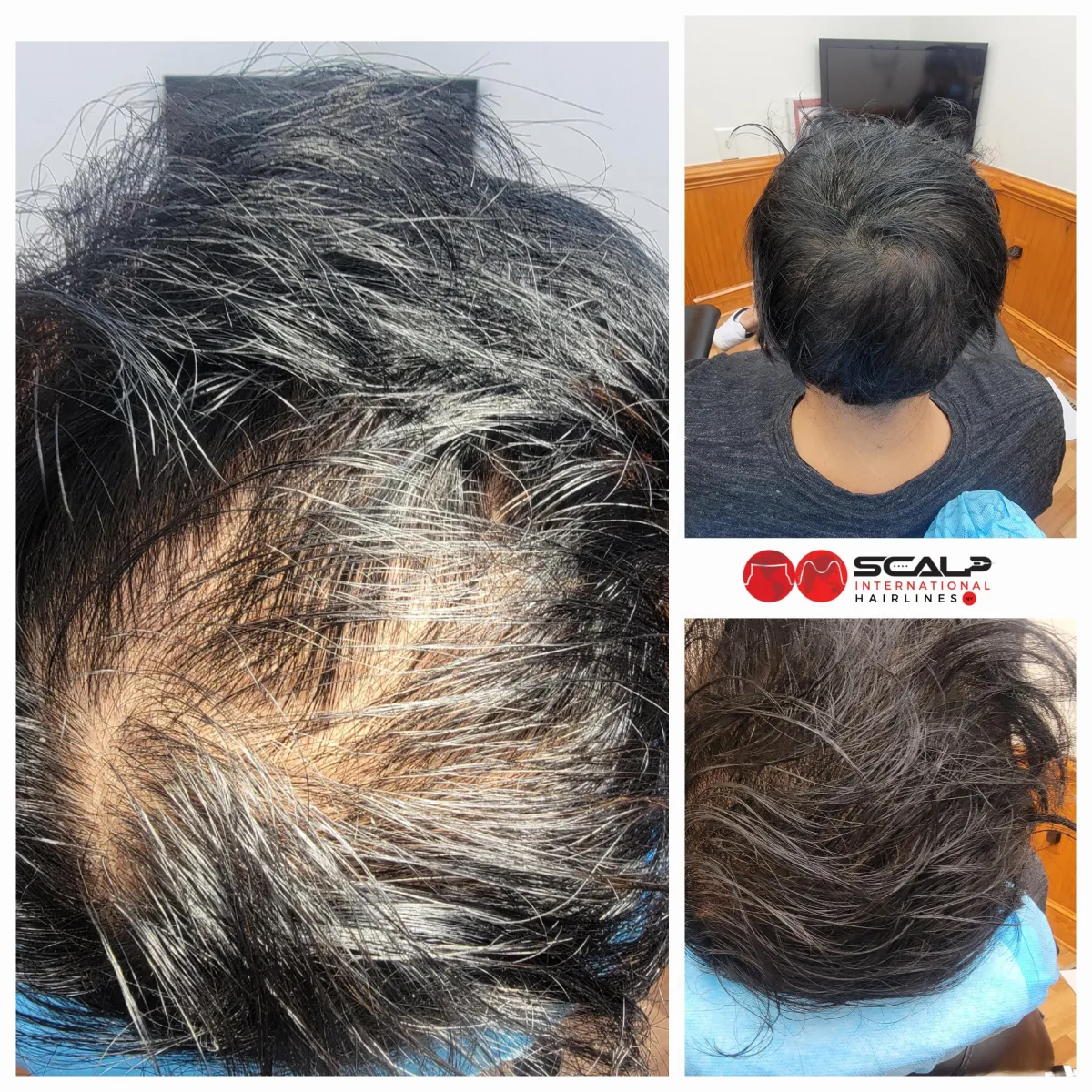 grayscale photography of woman wearing eyeglasses