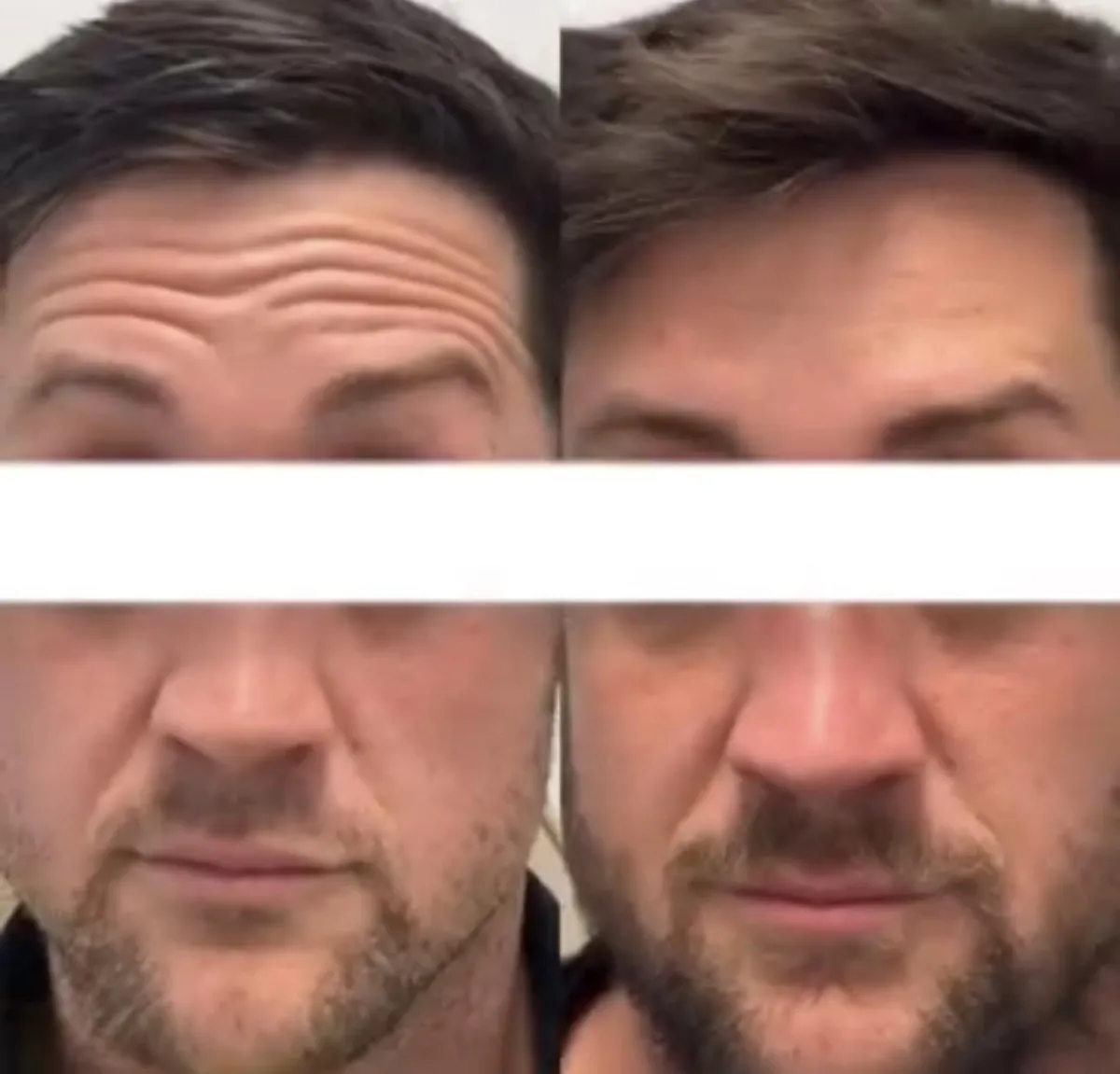 Anti Wrinkle For Men